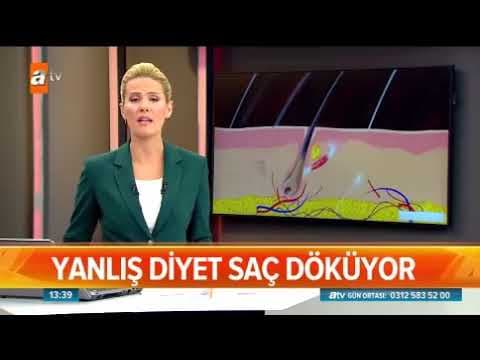 Yanlış Diyetler Saç Döküyor