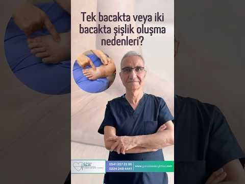Tek bacakta veya iki bacakta şişlik oluşma nedenleri