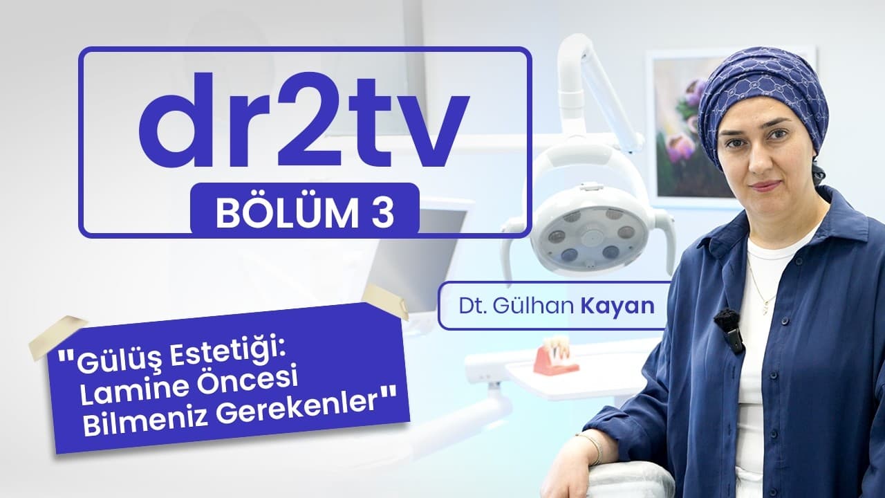 Kompozit Lamine ve Emax Lamine Nedir? Gülüş Estetiğinde Yöntemler