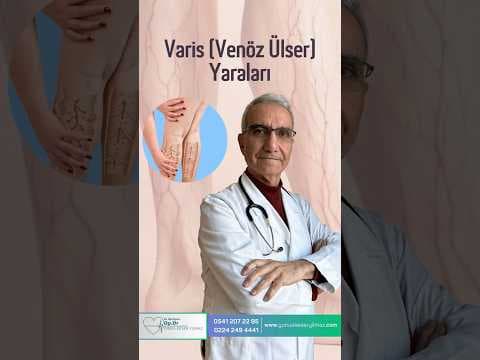 Varis (Venöz Ülser) Yaraları