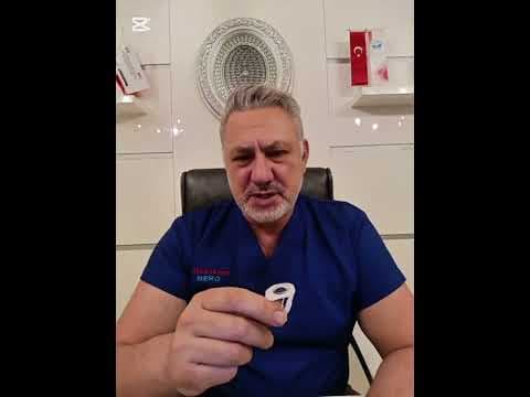 PLASTİK KLİPS TEKNİĞİ İLE SÜNNET