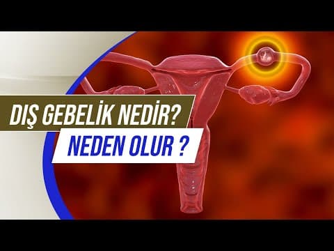 Dış Gebelik Nedir? Dış Gebelik Kaçıncı Haftada Olur? Dış Gebelik Belirtileri