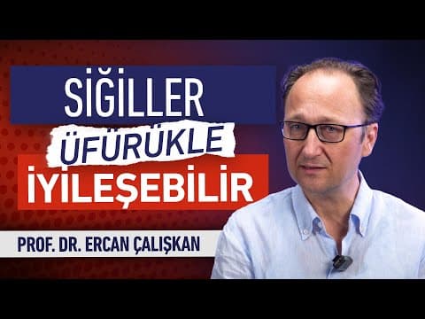 İncir Sütü Siğil Tedavisinde İşe Yarar Mı