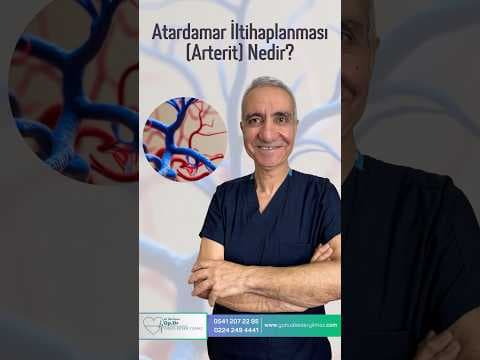 Atardamar İltihaplanması (Arterit) Nedir?