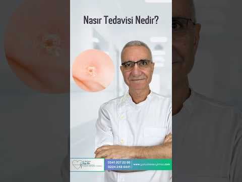 Nasır Tedavisi Nedir?