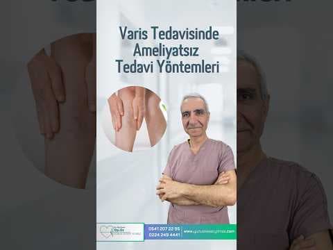 Varis Tedavisinde Ameliyatsız Yöntemler