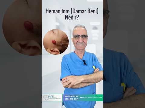 Hemanjiom (Damar Beni) Nedir?