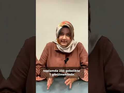 Çift ve tek yumurta ikizleri, ikizlik türleri arasında önemli farklılıklar gösterir.