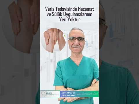 Varis Tedavisinde Hacamat ve Sülük Uygulamalarının Yeri
