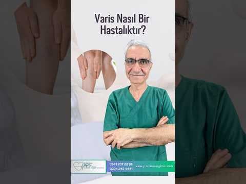 VARİS NASIL BİR HASTALIKTIR
