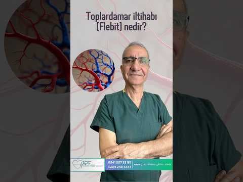 Toplardamar iltihabı (Flebit) nedir?
